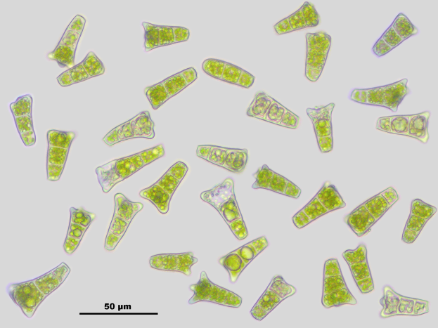 Eine Gruppe grüner Algenzellen auf einem grauen Hintergrund mit Text unten.